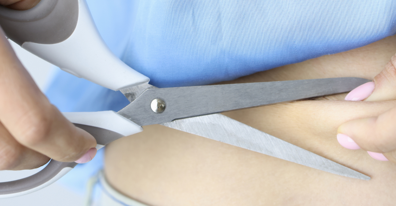 Eliminación del exceso de piel